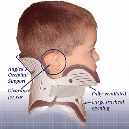 Picture of Rigid Cervical Collar NecLoc® Preformed Infant (0 to 24 Months) Size P1 Two-Piece / Trachea OpeningNL-P1