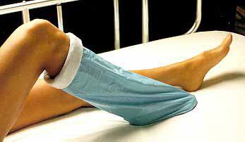 Picture of Stockinette Impervious Albahealth® 6 X 30 Inch Synthetic Sterile20630